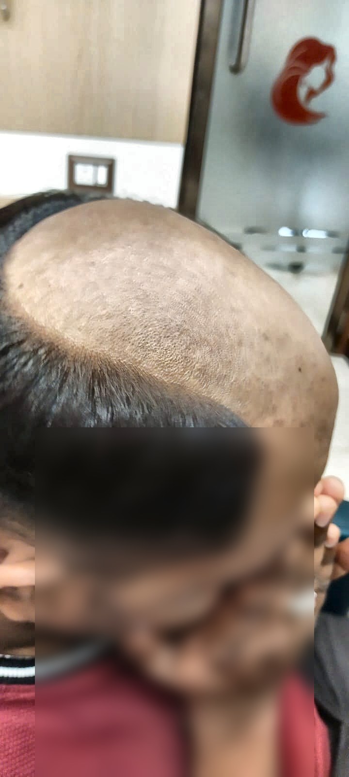 Complete Hair Patch Maintenance Guide (Daily, Weekly, Monthly)