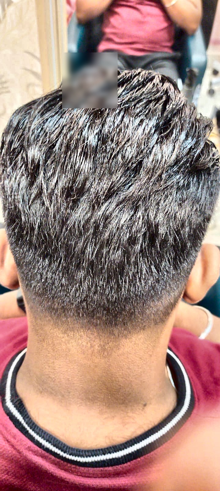 Cost of Hair Patch in Navi Mumbai (Updated 2026 Price Guide)